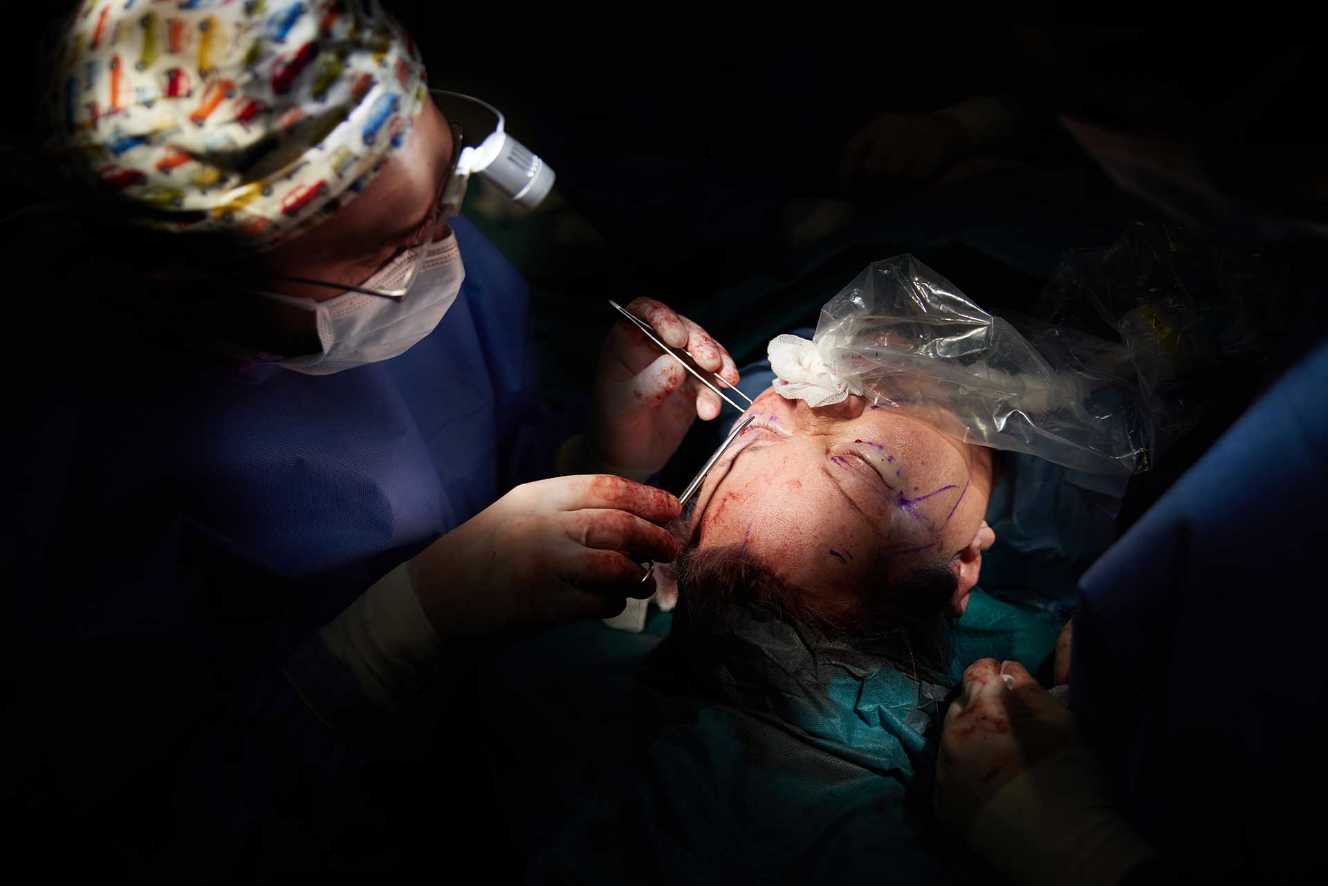 Kompleksowe odmłodzenie